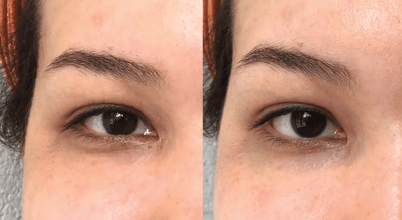 Peptide+ Intense Eye Recovery Serum – Refresh Skin Therapy